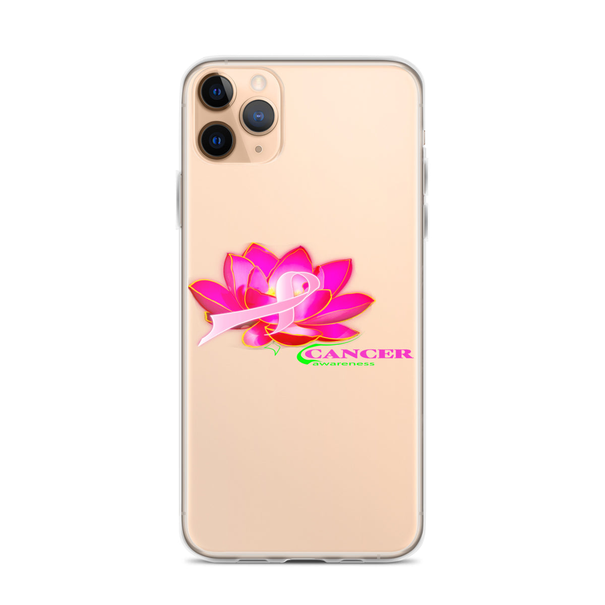 Clear Case for iPhone® | Lotus of Hope